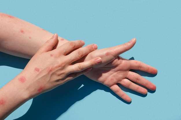 Определение проблем организма по состоянию ногтей и рук: 4 основных симптома