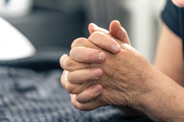 Степени развития и симптомы артроза пальцев рук