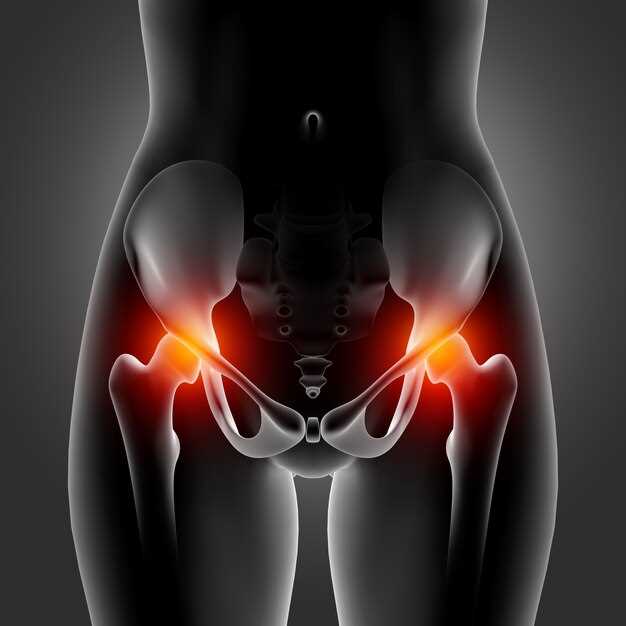 Артроз тазобедренных суставов: симптомы и лечение
