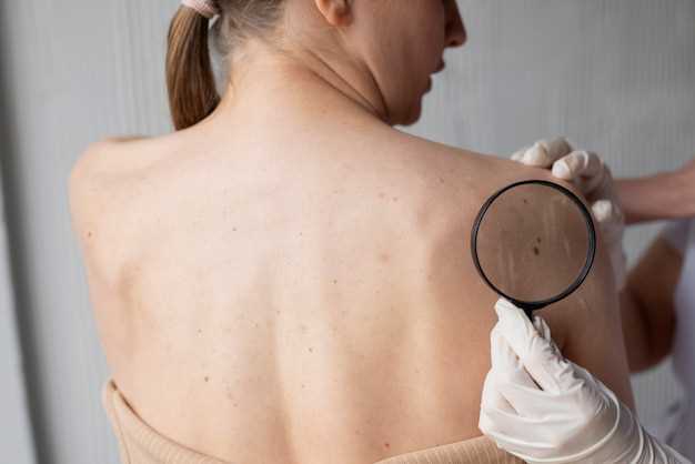 Натуральные методы удаления следов лейкопластыря на коже