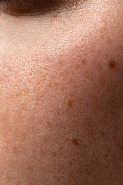 Герпетические высыпания на коже: виды, диагностика и лечение