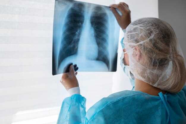 Как передается туберкулез: основные пути инфицирования