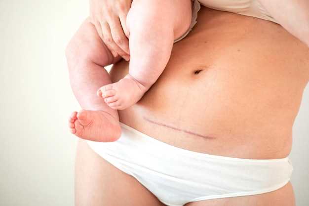 Советы по уходу за кожей после родов для ускорения процесса прохождения пигментации