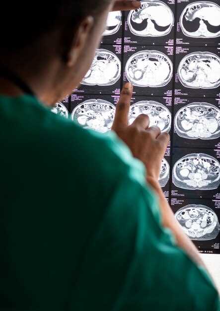 Детальная расшифровка результатов МРТ головного мозга: что говорят специалисты
