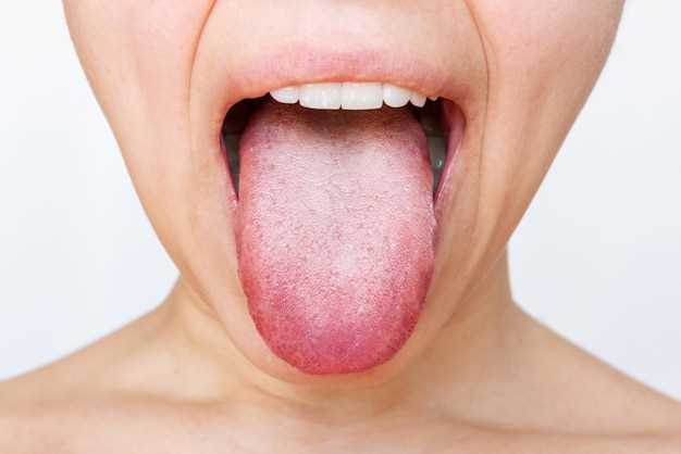 Симптомы онемения под языком