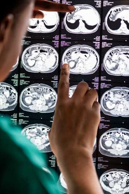 Возможные причины невозможности выявления опухоли МРТ