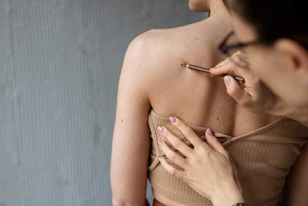 Симптомы и лечение сыпи на груди у женщины