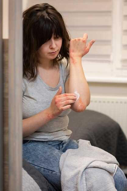 Как лечить сыпь на костяшках пальцев?