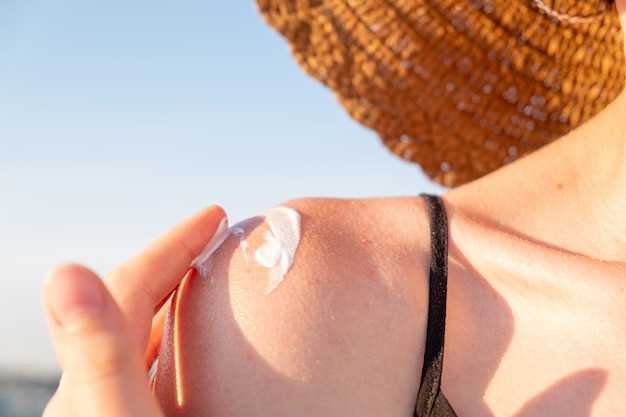Основные симптомы солнечного дерматита