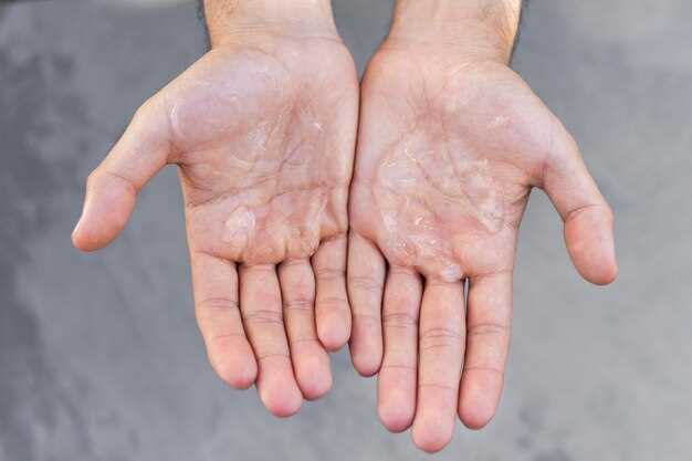 Способы лечения сыпи на пальцах рук