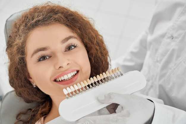 Виниры – инновационный метод лечения зубных дефектов