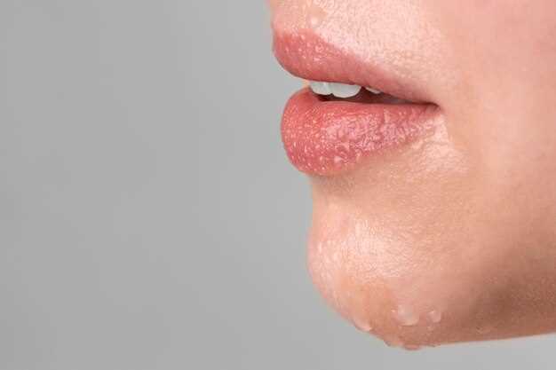 Методы лечения зуда и отека губ